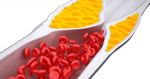 ¡Libera tus arterias de la amenaza del colesterol! Estos 11 deliciosos productos te ayudarán…