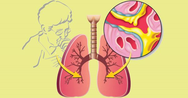 Un remedio «de la abuela» contra la tos. ¡Necesitarás solo un ingrediente!