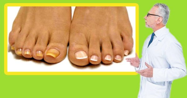 Ante qué remedio tiembla el hongo de las piernas Ante qué remedio tiembla el hongo de las piernas