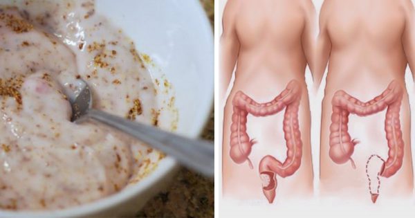 Un remedio que elimina 5 kg de toxinas en 20 días: ¡No sabía que tenía TANTO!