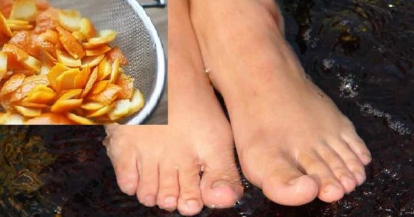 Ella colocó la cáscara de mandarina entre los dedos de pie… ¡Le salió un remedio increíblemente eficaz!