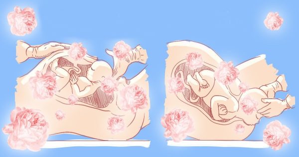 Niños por cesárea: ¿en qué se diferencian de los niños normales? 3 mitos y 2 verdades sobre bebés inusuales. Niños por cesárea: ¿en qué se diferencian de los niños normales? 3 mitos y 2 verdades sobre bebés inusuales.