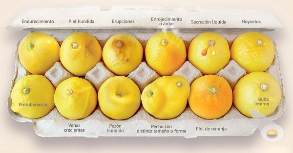 «Conoce tus limones»: Una campaña en la lucha contra el cáncer de mama que podría salvar tu vida…