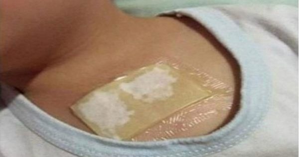 Esta cataplasma me salvó de la tos y la bronquitis más de una vez. Su poder está en el ingrediente secreto…