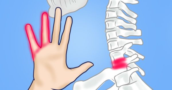 Por qué se adormecen las manos: 7 razones que te hacen pensar en la salud. Por qué se adormecen las manos: 7 razones que te hacen pensar en la salud.