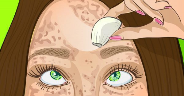 El remedio de la abuela para la piel perfecta. ¡Borra las manchas de la piel como una goma!