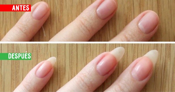 La magia de 3 ingredientes para devolver la belleza a tus uñas: ¡El resultado es a velocidad de un rayo!