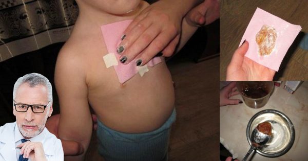 Ella le colocó ESTO en el pecho a su hijo enfermo, antes de ir a dormir. A la mañana siguiente… ¡Increíble!