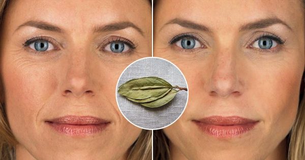 Cómo deshacerse de los pliegues nasolabiales: métodos efectivos