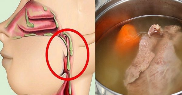 Cómo deshacerse de la mucosidad en el estómago y los intestinos