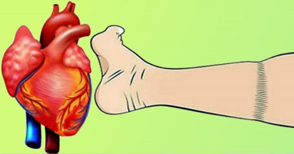 ¿Cómo detener un ataque cardíaco en un minuto? Aplica los primeros auxilios y llama urgente a una ambulancia.