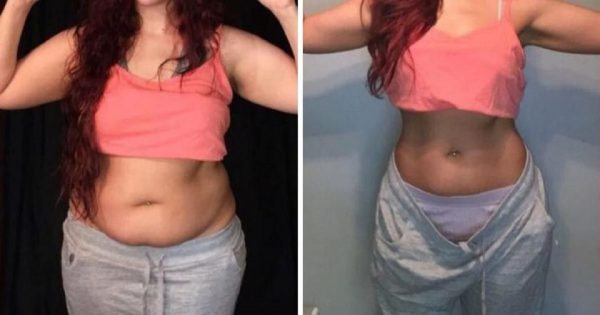 Cómo eliminar la flacidez del vientre sin dietas ni ejercicios extenuantes