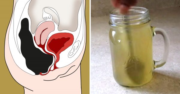 Esta bebida casera limpiará a fondo tus intestinos de toxinas. ¡Pruébala, te sentirás como nuevo!