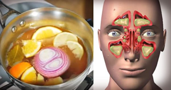 Un remedio poderoso: Deja la respiración libre y descongestionada.