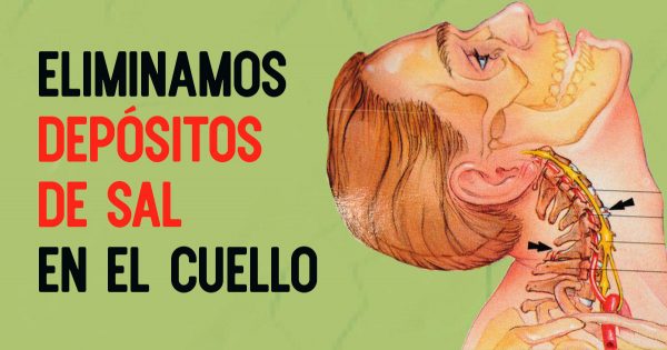 ¡Así es como «desprendes la sal» en el cuello! Adios a la osteocondrosis…