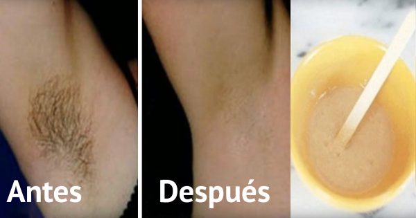 ¡Elimina el pelo no deseado de las axilas en sólo 2 minutos y sin irritación!