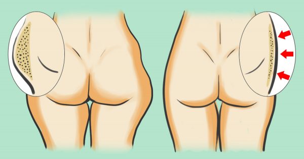 Un rito mañanero de 20 minutos para adelgazar. ¡No les queda chance a las calorías!