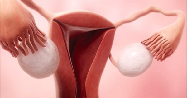 Dieta cruda vs. Menstruación. ¡Chicas, esta podría ser la receta ideal contra los dolores menstruales!