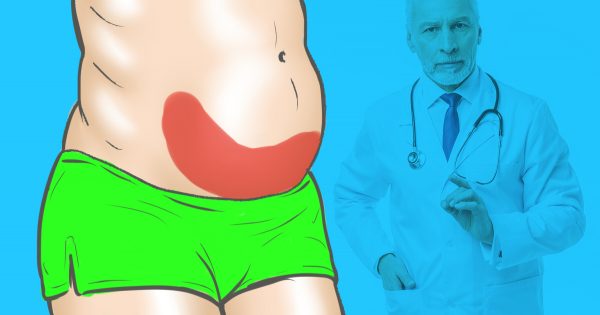 ¿Quién dijo que la celulitis se debe a los alimentos grasos? Con esta dieta, podrás librarte de ella en un santiamén…