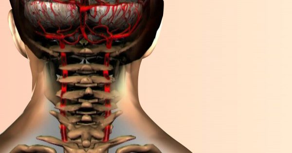 El 90% de la población mundial sufre de osteocondrosis cervical. No la subestimes…