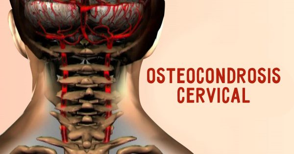 Que anestesia a los dolores de la columna vertebral sheynogo del departamento