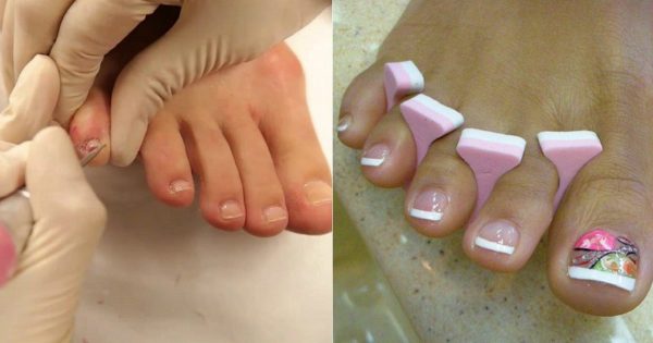 15 grandes ideas para la pedicura de verano. ¡Justo lo que necesitaba para lucir mis nuevas sandalias!