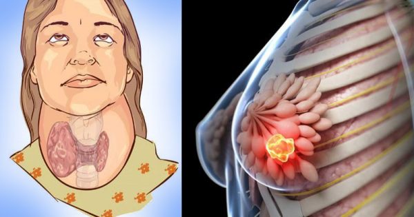 Siempre pensé que era una bebida útil. ¡Resulta que afecta la glándula tiroides y más!