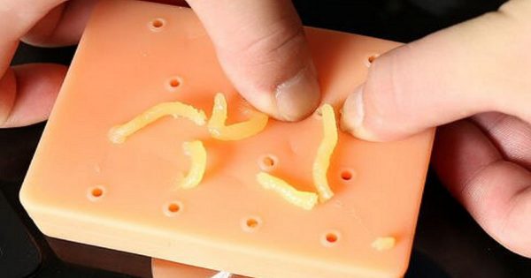 Manifestaciones físicas del estrés