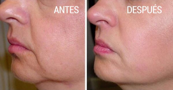 Remedio Nro 1 contra las arrugas, que todos tenemos en casa. ¡No más piel arrugada!