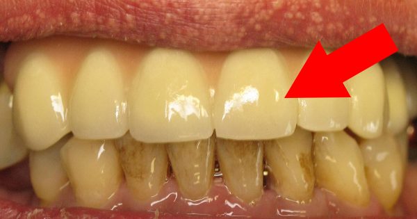 A lo largo de 72 años, mi abuelo nunca fue al dentista… ¡Es que 3 veces a la semana, se aplica ESTO!