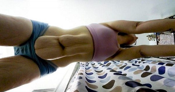 Ella gastó más de 100 mil dólares para adelgazar. Ahora, odia su cuerpo…