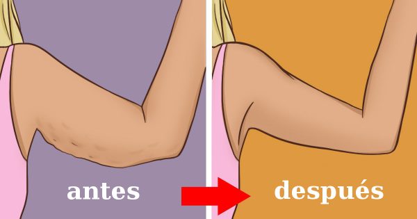 ¡Di adiós a los brazos flácidos! En solo 4 semanas, los tendrás elegantes y tonificados.