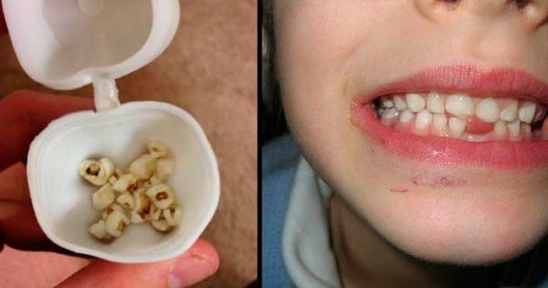 ¡No botes los dientes de leche de tus hijos! Esos pequeños recuerdos son una mina de oro para tu salud…