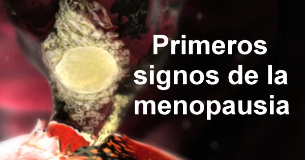 ¡El climaterio puede ser ralentizado! Lo principal es reconocer los primeros avisos.