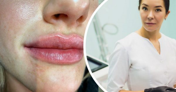 Procedimientos cosméticos que es mejor rechazar