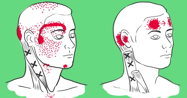 La falta de estos productos causa el dolor de cabeza. ¡Qué pena que no lo sabía antes!