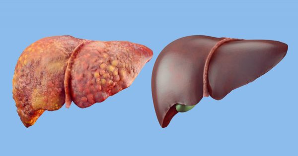 Estos 6 productos desintoxicarán tu cuerpo. ¡Esto sí que funciona!