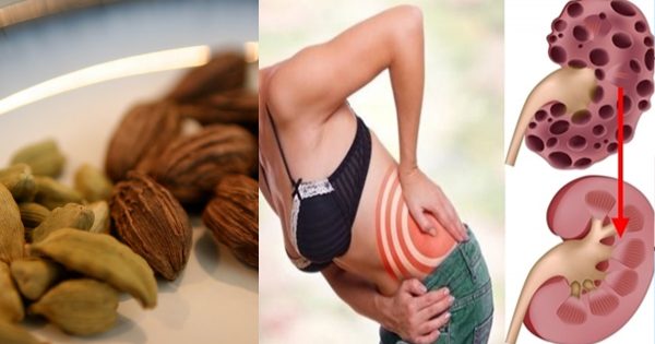 ¡Un pequeño suplemento a tu café, y olvidarás para siempre de los problemas con riñones!