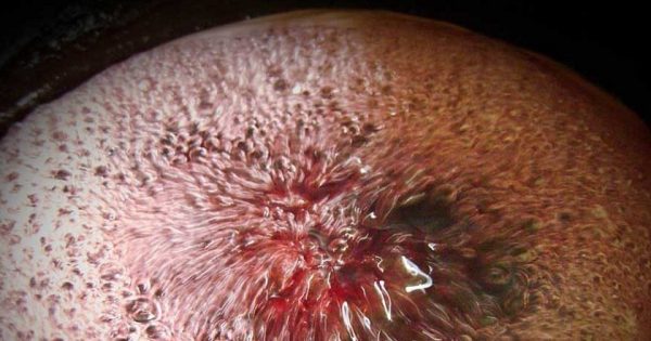 ¿A qué personas les hace daño comer gelatina?