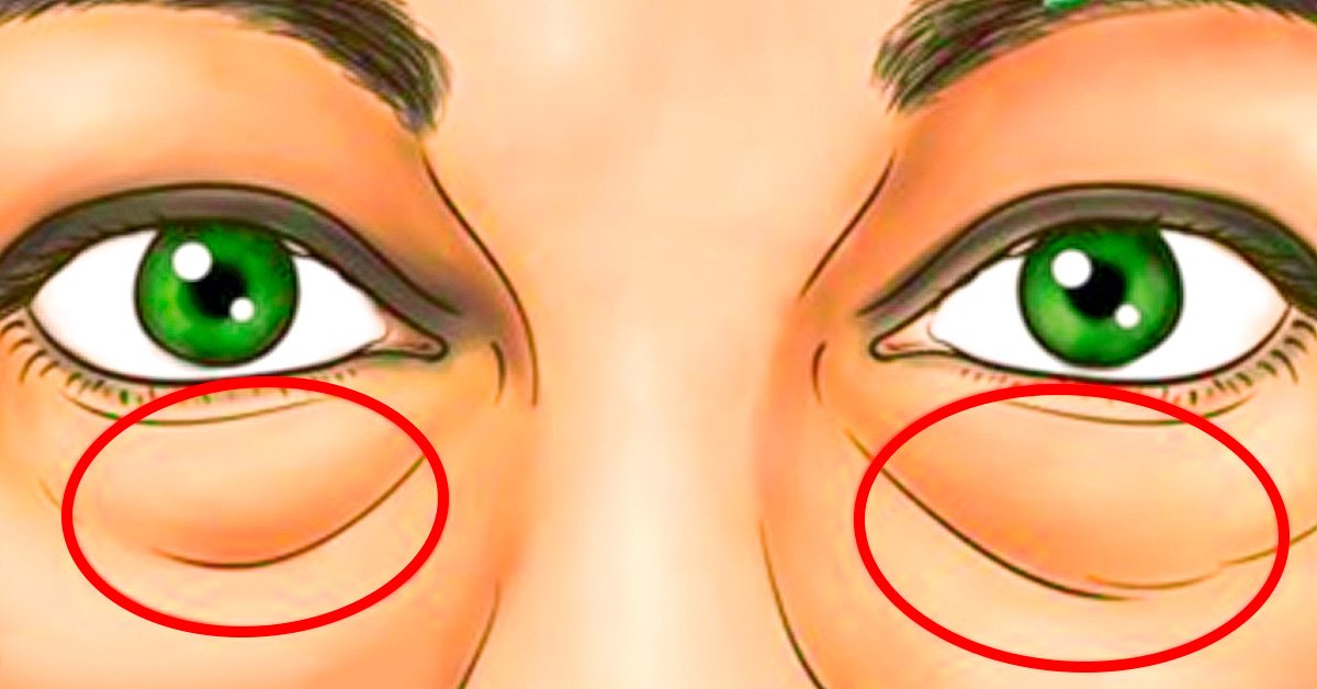 Las máscaras para la persona con la miel de la foto antes y después