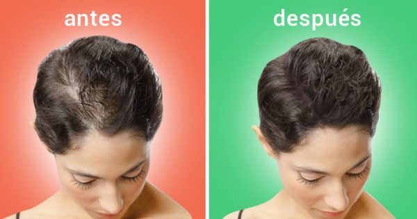 Remedio eficaz para el crecimiento del cabello.