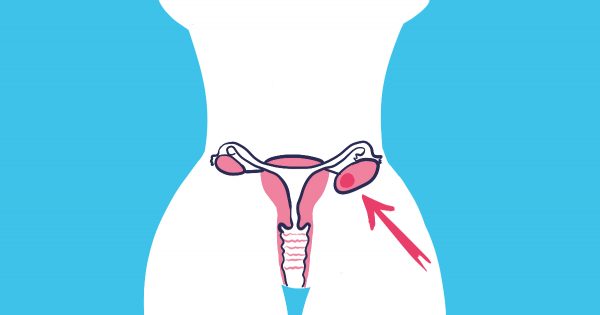 ¿Deseas deshacerte de los quistes ováricos y los miomas? Este eficiente batido es insuperable…