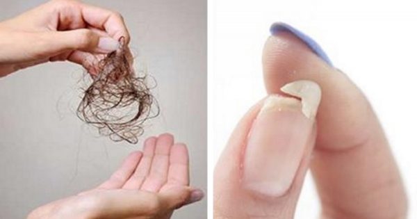 ¿Estás perdiendo mucho cabello, y tus uñas se quiebran con facilidad? He aquí la solución…