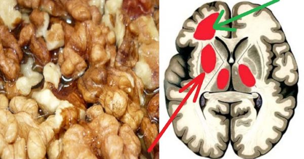 5 remedios naturales para eliminar la placa de los vasos sanguíneos… ¡Receta para una salud de oro!