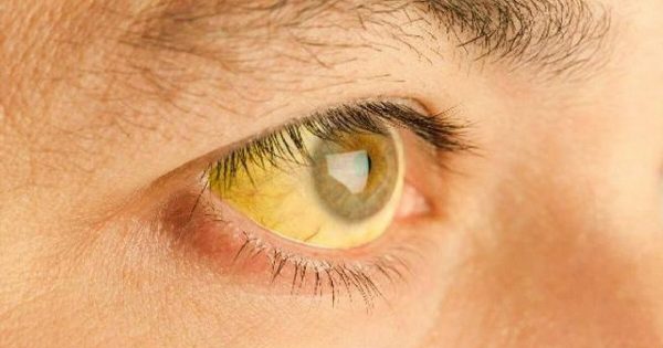 ¿Sabías que el estado de la salud se puede conocer a través de los ojos?  ¡Presta atención a estas 8 señales!