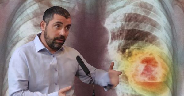 Este médico israelí te dirá cómo atajar el cáncer en una etapa temprana. ¡Recomendaciones que salvan la vida!