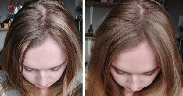 12 maneras de utilizar soda para la belleza. ¡El remedio más económico y universal!