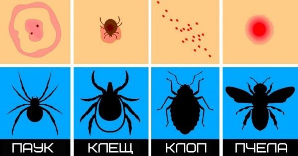 Tipos de picaduras: cómo entender quién mordió