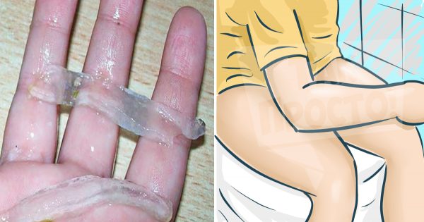 La instalación, que le ayudará a deshacerse de las hemorroides de una vez por todas!