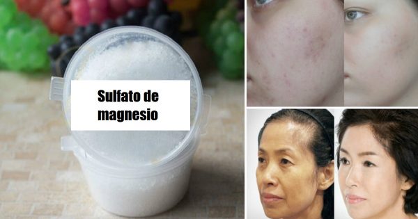 El sulfato de magnesio es muy útil en la medicina, pero…  ¡Quién iba a decir que también tiene otros beneficios!